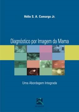 Imagem de DIAGNOSTICO POR IMAGEM DA MAMA - UMA ABORDAGEM INTEGRADA