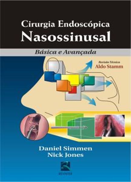Picture of CIRURGIA ENDOSCOPICA NASOSSINUSAL
