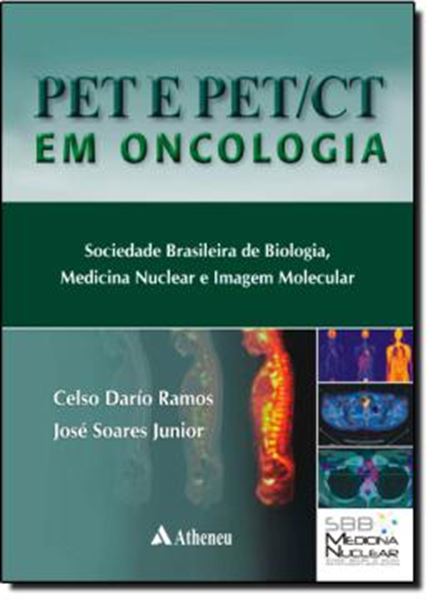Picture of PET E PET/CT EM ONCOLOGIA - SOCIEDADE BRASILEIRA DE BIOLOGIA, MEDICINA NUCLEAR E IMAGEM MOLECULAR 