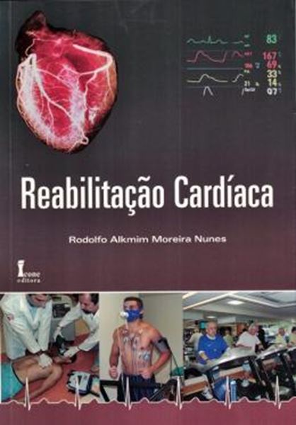 Picture of REABILITACAO CARDIACA