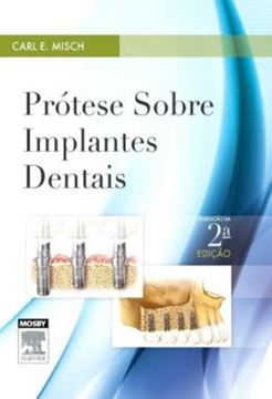 Imagem de PROTESE SOBRE IMPLANTES DENTAIS - 2 ED