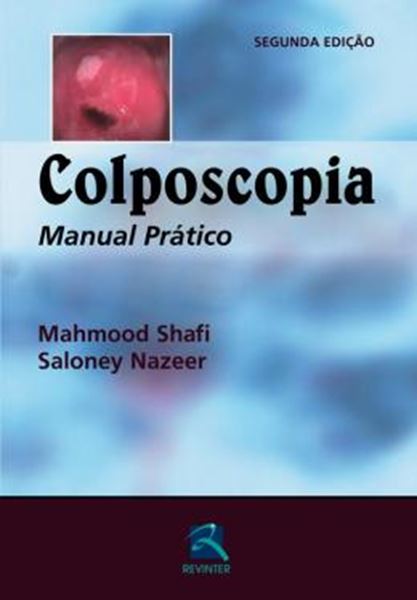 Picture of COLPOSCOPIA - MANUAL PRATICO - 2ª ED