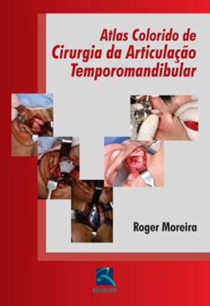 Picture of ATLAS COLORIDO DE CIRURGIA DA ARTICULACAO TEMPOROMANDIBULAR