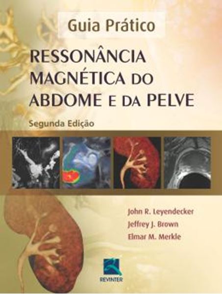 Picture of RESSONANCIA MAGNETICA DO ABDOME E DA PELVE - 2ª ED