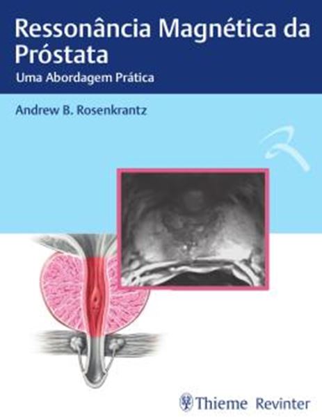 Picture of RESSONANCIA MAGNETICA DA PROSTATA 
