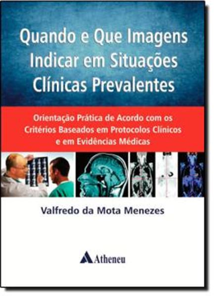 Picture of QUANDO E QUE IMAGENS INDICAR EM SITUACOES CLINICAS PREVALENTES