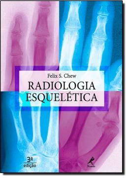 Imagem de RADIOLOGIA ESQUELETICA - 3ºED
