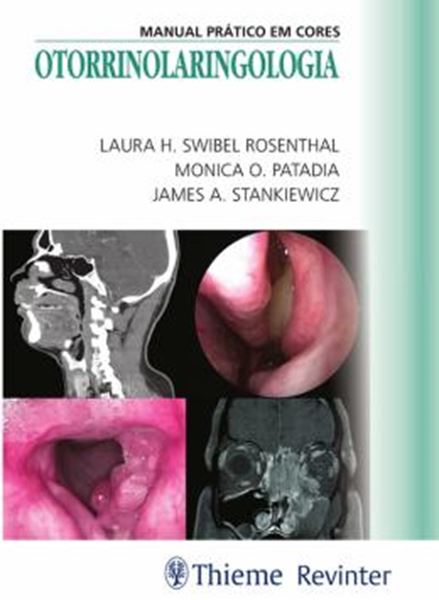 Picture of OTORRINOLARINGOLOGIA - MANUAL PRATICO EM CORES