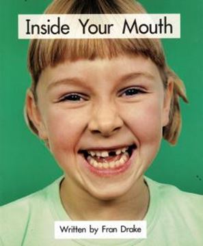 Imagem de INSIDE YOUR MOUTH