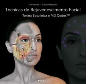 Imagem de TECNICAS DE REJUVENESCIMENTO FACIAL - TOXINA BOTULINICA E MD CODES