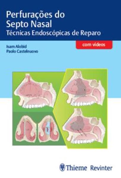 Picture of PERFURACOES DO SEPTO NASAL - TECNICAS ENDOSCOPICAS DE REPARO