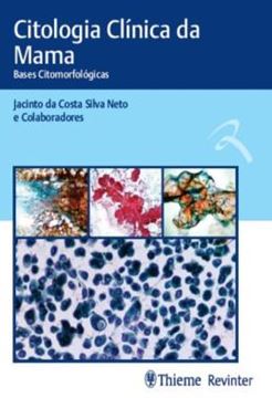 Imagem de CITOLOGIA CLINICA DA MAMA - BASES CITOMORFOLOGICAS
