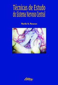 Imagem de TECNICAS DE ESTUDO DO SISTEMA NERVOSO CENTRAL