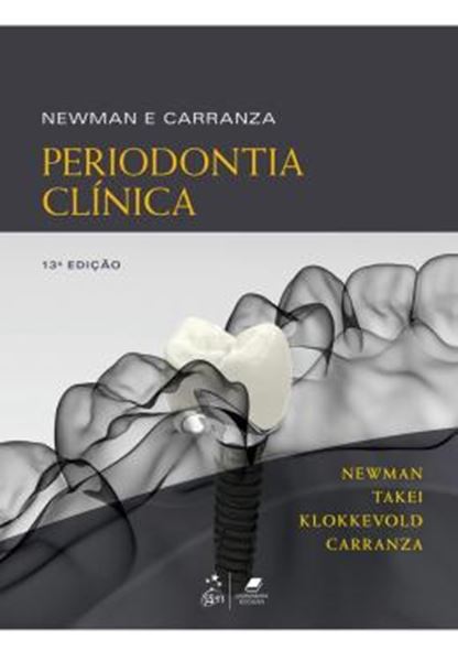 Picture of PERIODONTIA CLINICA - 13ª ED