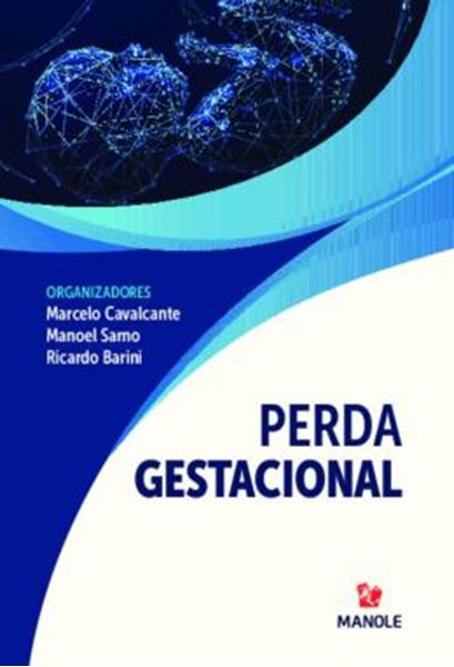 Picture of PERDA GESTACIONAL
