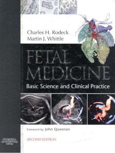 Picture of FETAL MEDICINE - BASIC SCIENCE AND CLINICAL PRACTICE - 2ND ED