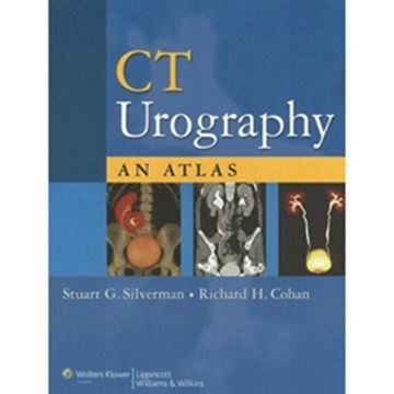 Imagem de CT UROGRAPHY - AN ATLAS