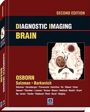 Imagem de DIAGNOSTIC IMAGING: BRAIN - 2ND EDITION