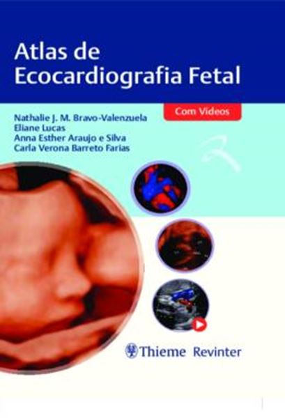 Picture of ATLAS DE ECOCARDIOGRAFIA FETAL