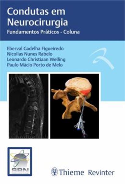 Picture of CONDUTAS EM NEUROCIRURGIA - FUNDAMENTOS PRATICOS - COLUNA