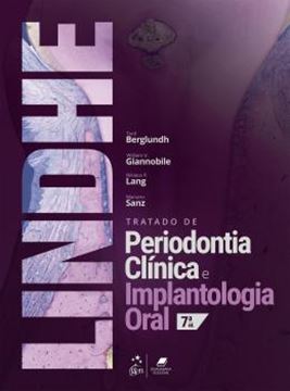 Imagem de TRATADO DE PERIODONTIA CLINICA E IMPLANTOLOGIA ORAL - 7ª ED