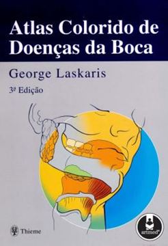 Imagem de ATLAS COLORIDO DE DOENCAS DA BOCA - 3º EDICAO