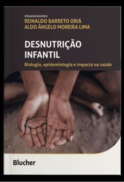 Picture of DESNUTRICAO INFANTIL - BIOLOGIA, EPIDEMIOLOGIA E IMPACTO NA SAUDE