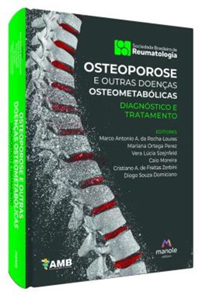 Picture of OSTEOPOROSE E OUTRAS DOENCAS OSTEOMETABOLICAS