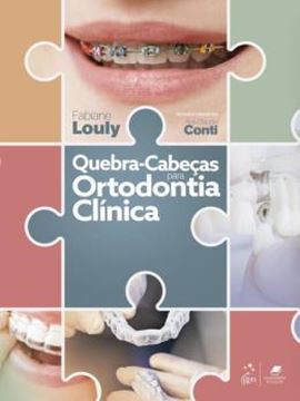 Imagem de QUEBRA-CABECAS PARA ORTODONTIA CLINICA