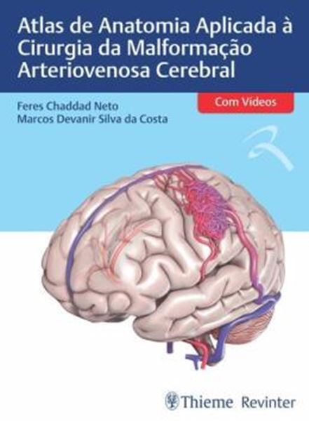 Picture of ATLAS DE ANATOMIA APLICADA A CIRURGIA DA MALFORMACAO ARTERIOVENOSA CEREBRAL