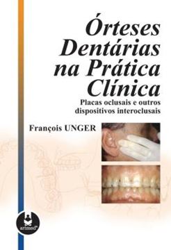 Imagem de ORTESES DENTARIAS NA PRATICA CLINICA